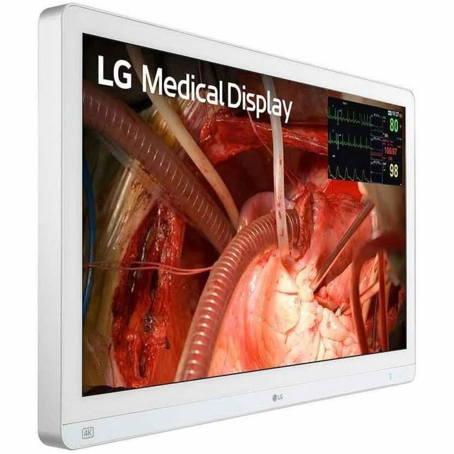 LG medical display showing surgical procedure with vital signs monitoring overlay-alternate-image1