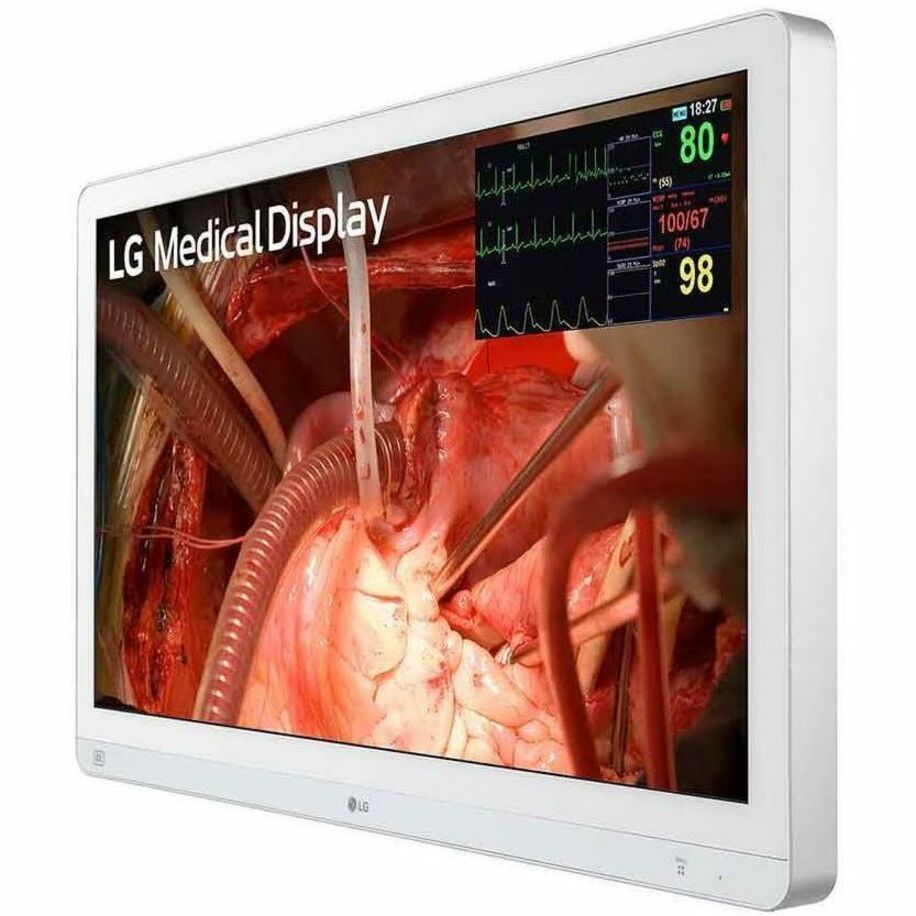 Angled view of LG medical monitor displaying surgical imagery-alternate-image6