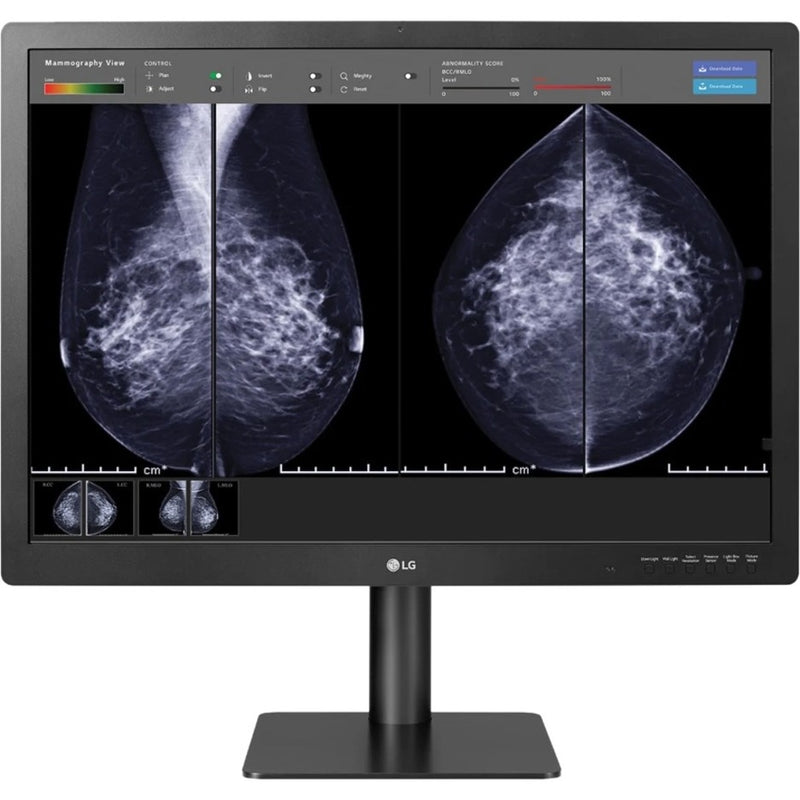 Full mammography workstation display with multiple viewing angles