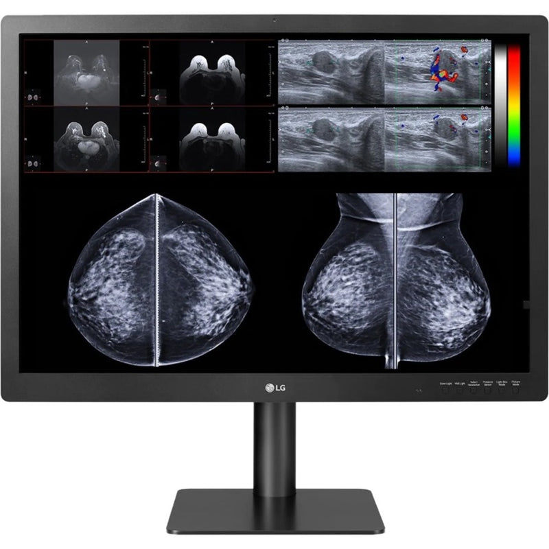 LG diagnostic monitor showing detailed mammography scans with pathology visualization features