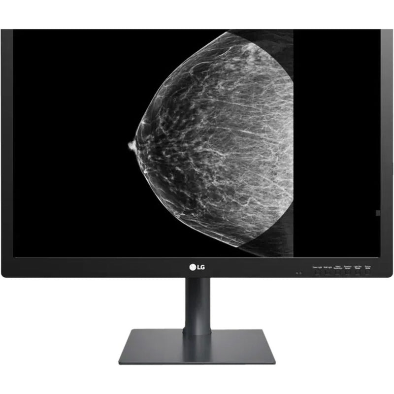 LG medical monitor displaying detailed mammogram with precise tissue visualization