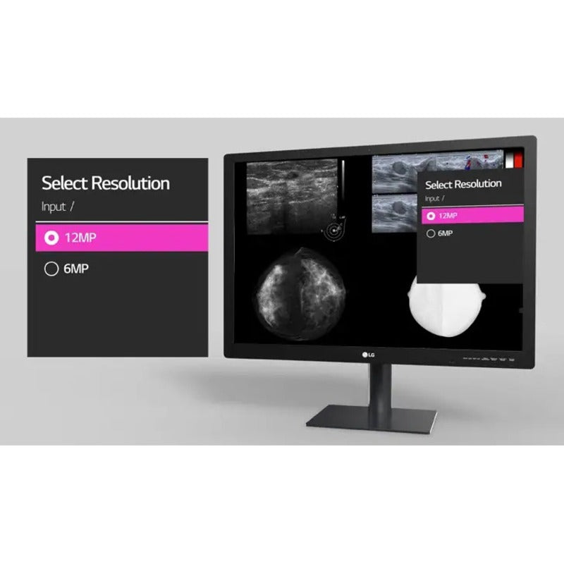 Screen showing resolution selection interface for medical imaging