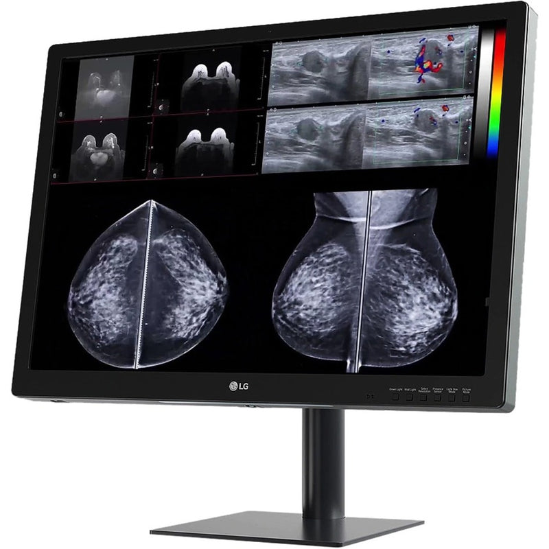 LG medical monitor displaying multiple mammography images with ultrasound and diagnostic scans in high resolution