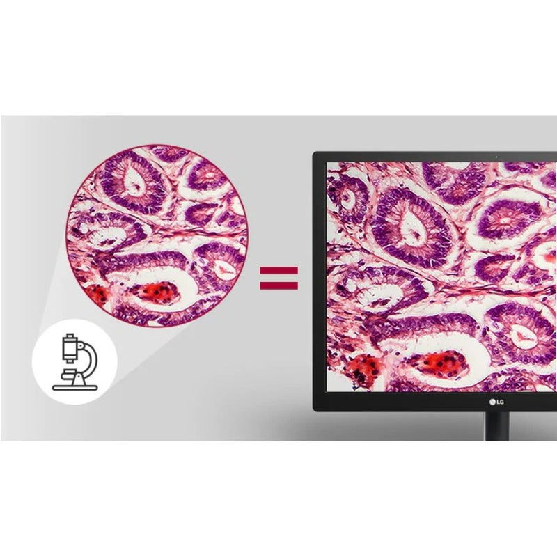 LG monitor displaying pathology slide with precise color reproduction