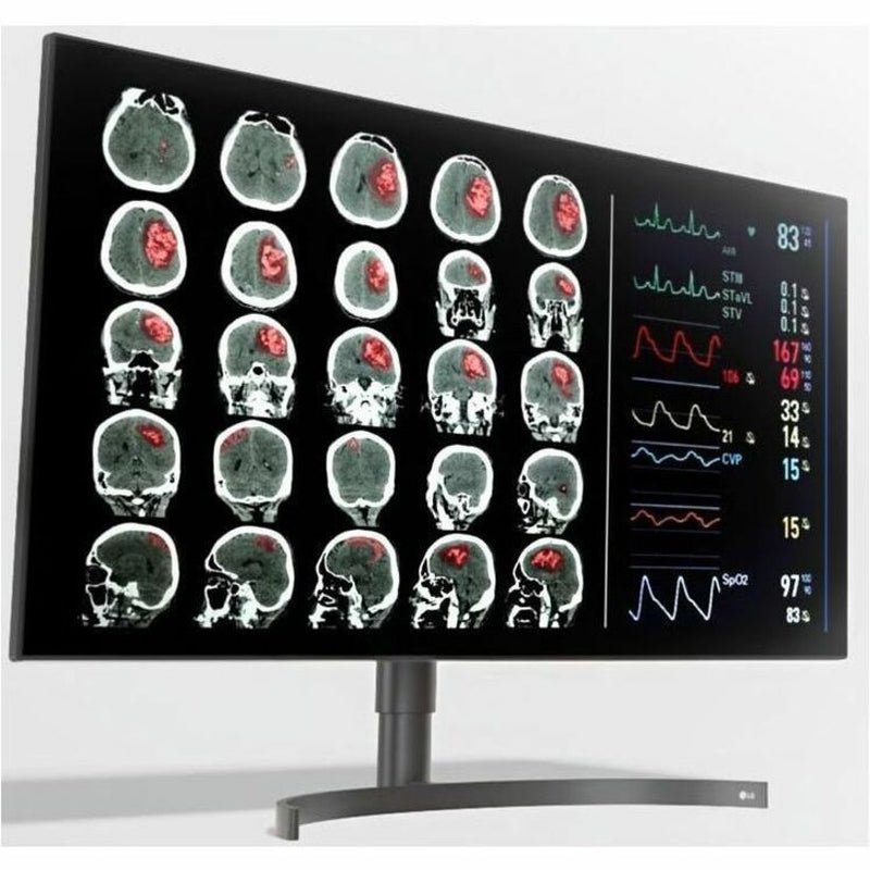 LG monitor displaying detailed medical scan images with vital signs